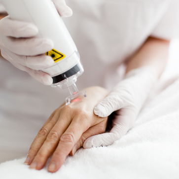 Lasers And Procedures